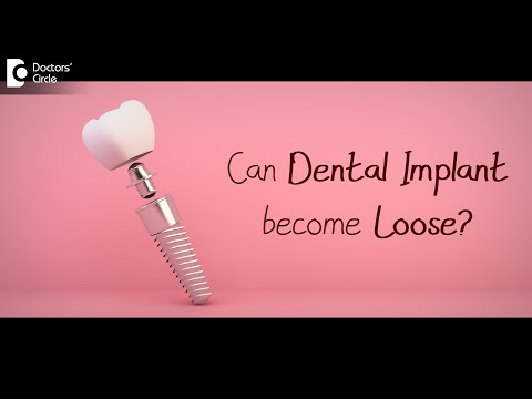 Can a Dental Implant become loose? Causes & Remedy - Dr. Deepa Jayashankar| Doctors' Circle