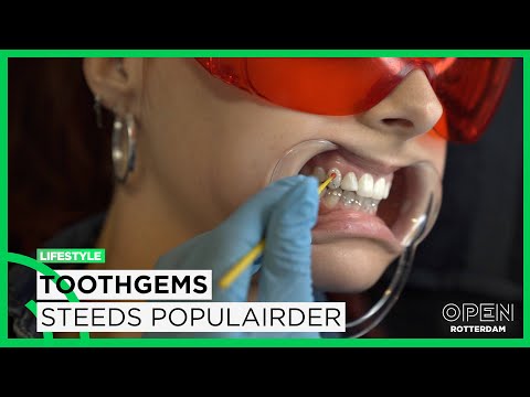 Tandenfee Eliza blinkt uit in het zetten van toothgems | LIFESTYLE
